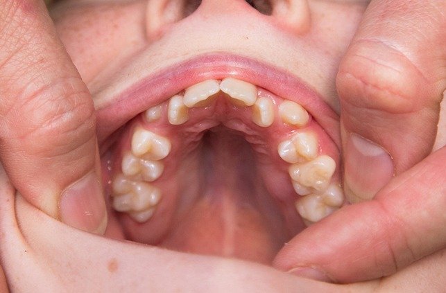 Dentist examining smile to be treated with dentofacial orthopedics