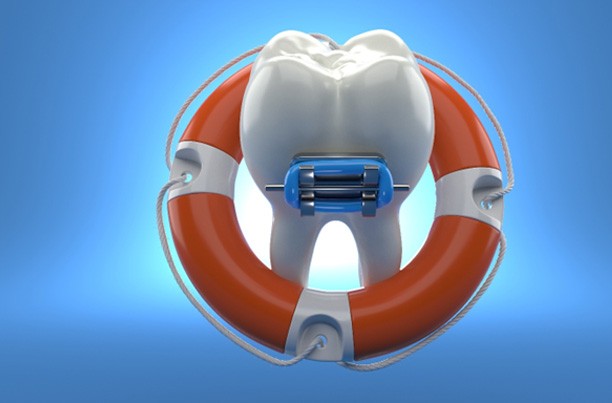 illustration of tooth with braces in lifebuoy
