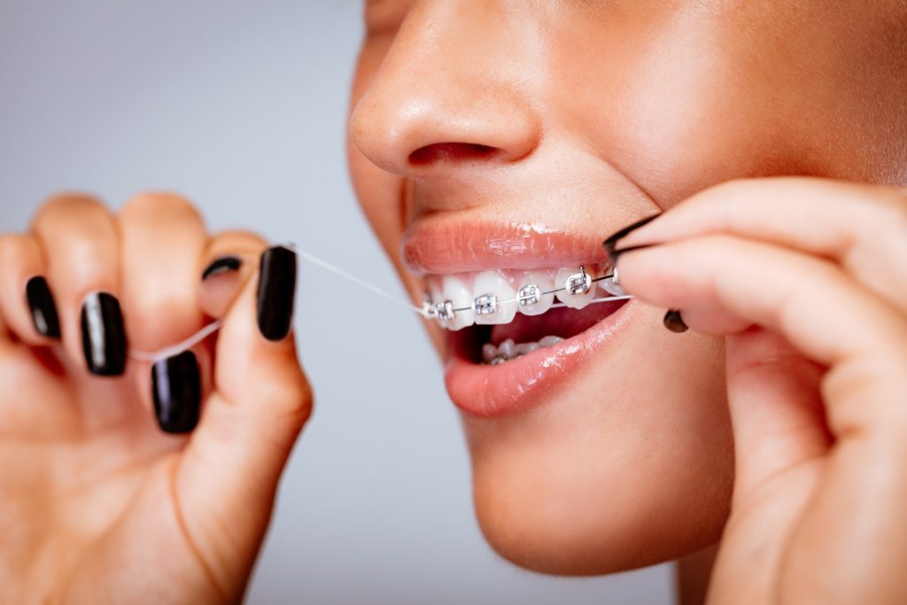 Closeup of woman with braces flossing